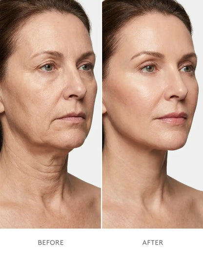 5%VOLUFILINE PDRN COLLAGEN GUA SHA MASSAGER